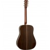 Martin D-28 Sunburst